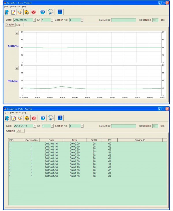 Pulsossimetro Saturimetro Palmare Display 2,8" LCD con Sensore Adutli a Clip, Sonda Temperatura e Batteria Ricaricabile